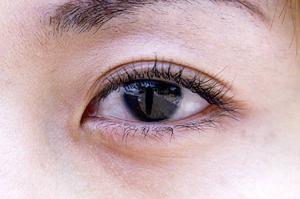 クマ取りを大阪ですると考えるなら